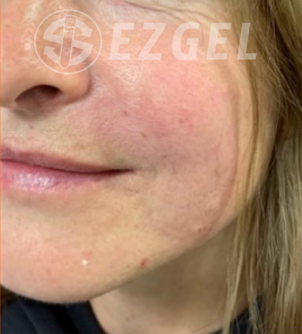 Psi ezgel c after