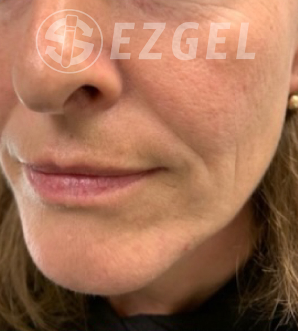 Psi ezgel c before