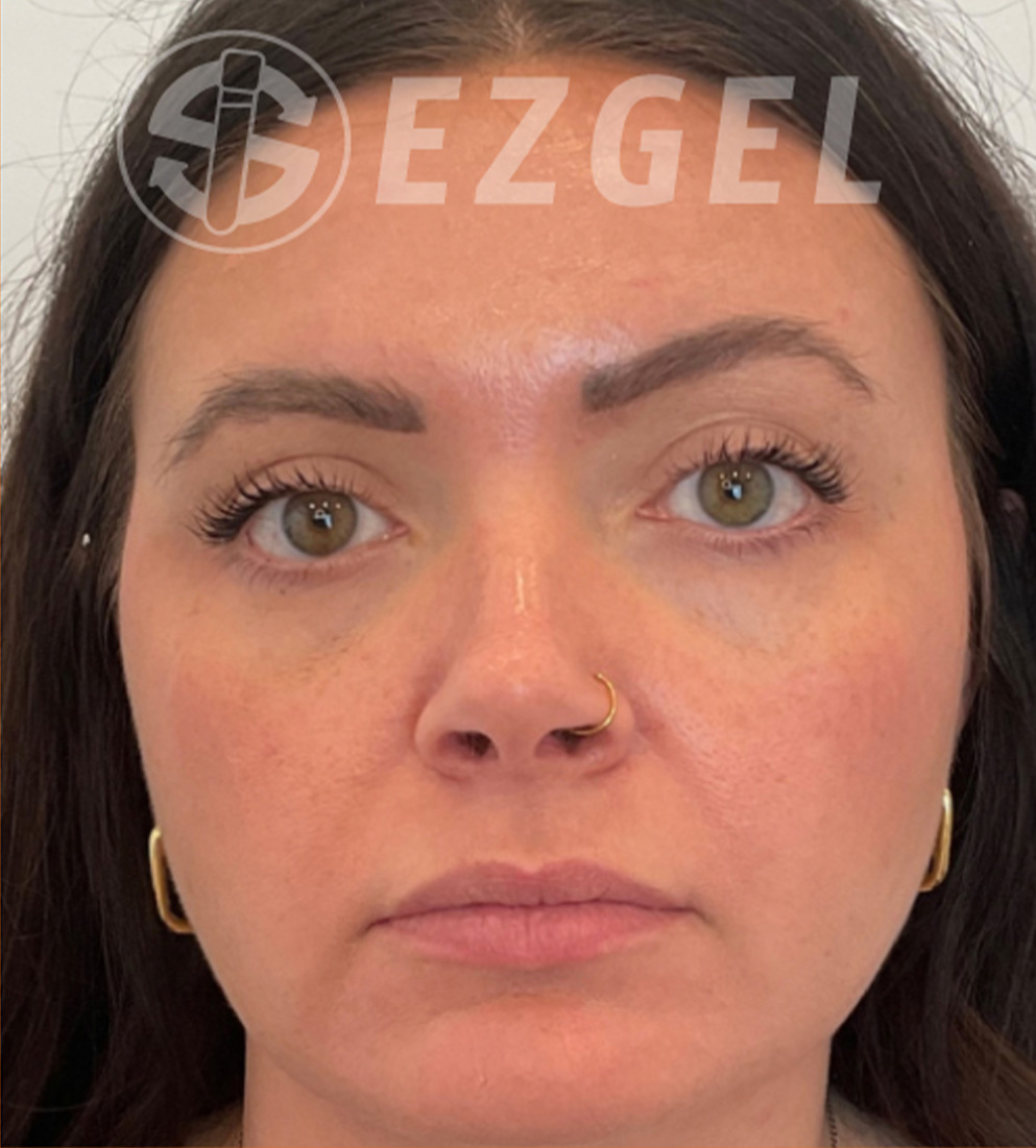 Psi ezgel d after