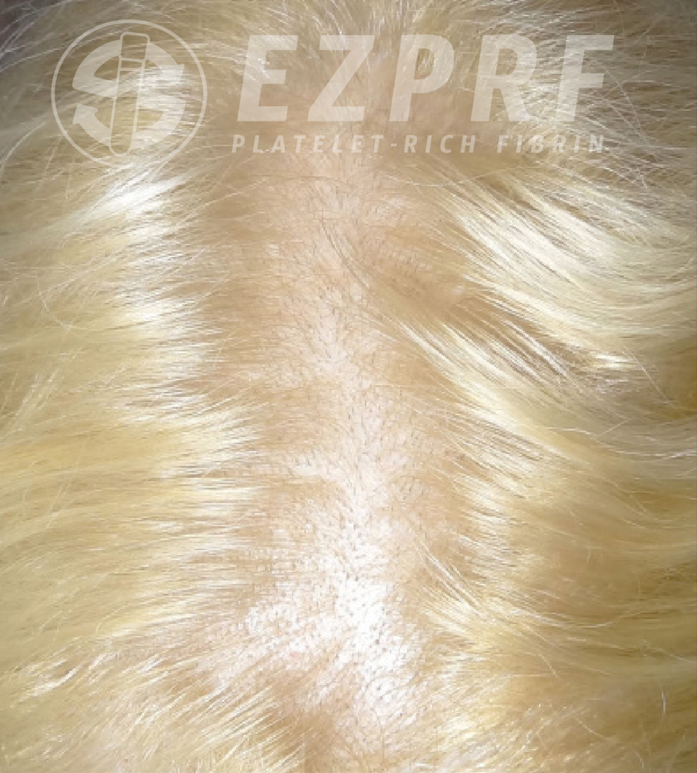 Psi ezprf hair b